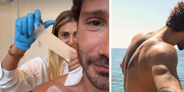 Stefano De Martino cancella il tatuaggio dedicato a Belen Rodriguez